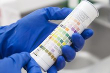 Normal Levels of Urine Creatinine & Protein
