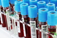 Raised Liver Enzymes and a Low White Blood Cell Count