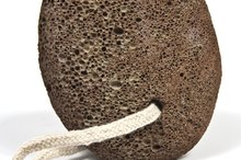 How to Treat Cracked Diabetic Feet