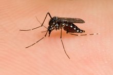 How to Get Rid of Dark Spots From Mosquito Bites