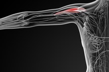 Exercising with a Deltoid Strain