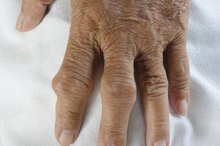 Juices That Help Gout