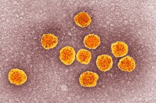 Stool Symptoms of Hepatitis C