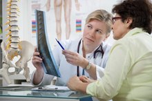 What are the Problems After a Spinal Fusion of C-5 & C-6?