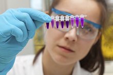 Normal DHEA Levels in Women
