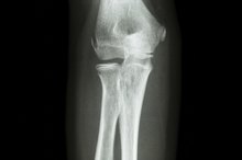 Diseases of the Ligaments