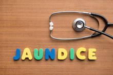 3 Types of Jaundice