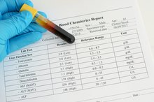 Elevated Liver Enzymes and Congestive Heart Failure