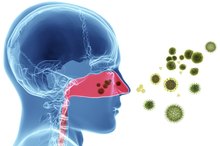 Herbal Remedies for Nasal Polyps
