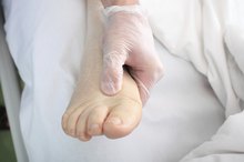 Is There a Natural Way to Get Rid of Fluid in the Body?