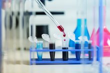 Symptoms of Low Blood Platelet Count in the Elderly