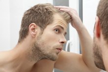 How to Tell If Your Hairline Is Receding