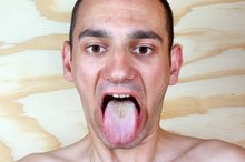 Facial Fungus: The Symptoms