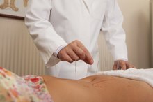 Acupuncture & Hormone Balance