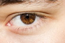 How to Diagnose Puffy Eyelids That Won't Go Away