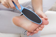 Acid for a Foot Callus