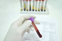 Blood Type O on the Non-Secretor Diet
