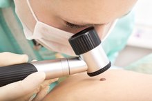 Facts About Red Moles