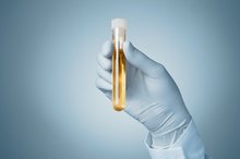 What Is Plus 4 in Glucose Levels?