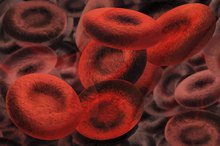 Thalassemia in Athletes
