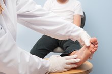 Cantharidin Side Effects