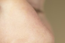 How to Get Back Into Shape After Septoplasty