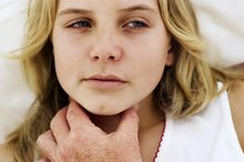 Group C Strep Treatment