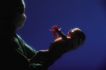 Hypoxia of a Newborn