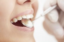 Vitamins for Receding Gums