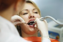 Toothache Pain From a Lost Filling