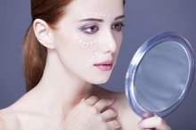 Alternatives to Benzoyl Peroxide