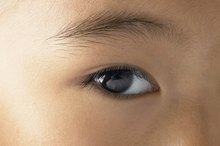 Skin Problems That Cause Eyebrow Loss