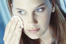 Allergic Reaction to Salicylic Acid