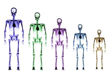 Knee and Muscle Pain in a Teen Boy With a Growth Spurt