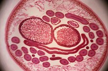 Symptoms of Roundworms in People