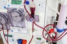 How Is Osmosis Used in Kidney Dialysis?