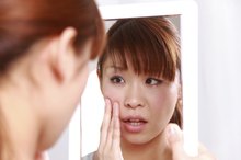 Allergies That Cause Facial Breakouts