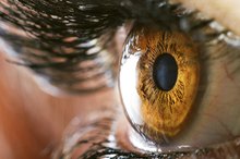 High Cholesterol Effects on Eyes