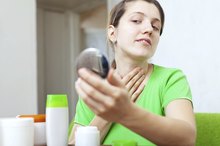 Causes of Neck Rash