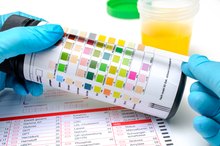 Leukocytes in Urine in Children