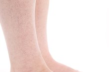 Dull Aches in the Shin