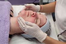 How to Treat a Scar From a TCA Peel