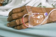 The Long-Term Side Effects of Doxorubicin