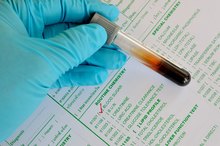 Testing for Toxins in the Blood