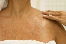 How to Restore the Pigment to White Spots on the Skin