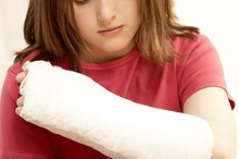 The Best Way to Remove Dead Skin After a Cast Removal