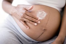 How to Get Rid of Stretch Marks on Dark Skin