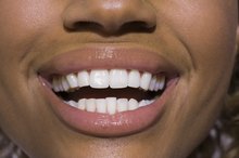 How to Make Your Own Tooth Caps
