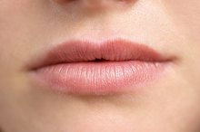 Can You Get a Ringworm on the Mouth?