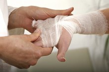 Signs of a Torn Ligament in the Finger